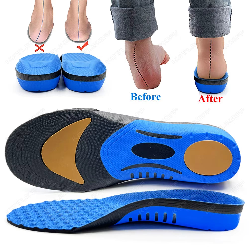 Best Insoles for Feet Orthopedic Valgus Insoles Templates Flat Foot Arch Running Arch Support Shoes Accessories Insert Men Women